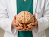 meningioma, tumor cerebral, IA