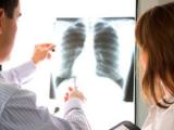 Estatinas no provocan enfermedad pulmonar intersticial