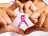Análisis de ADN tumoral circulante monitorea el cáncer de mama metastásico