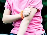 Psoriasis pediátrica incrementa la adiposidad corporal