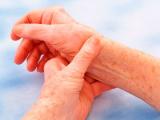 La aterosclerosis aumenta la presencia y progresión de la osteoartritis