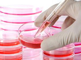 Trasplante de células hematopoyéticas mejora la supervivencia