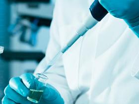 Biomarcador A1AT detecta el cáncer de vejiga