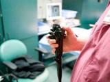 Colonoscopia y sigmoidoscopia previenen el cáncer colorrectal