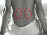 Enfermedad renal crónica prevalece en la psoriasis