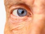 Antioxidantes disminuyen la presencia de cataratas