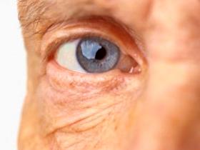 Antioxidantes disminuyen la presencia de cataratas