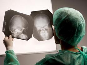 Malformaciones del desarrollo cortical promueven el déficit neurológico
