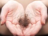 Inhibidor de quinasas revierte la alopecia areata
