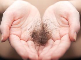 Inhibidor de quinasas revierte la alopecia areata