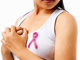 ICAM-1: marcador fiable para el cáncer de mama triple negativo