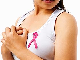ICAM-1: marcador fiable para el cáncer de mama triple negativo