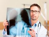 Simpatectomía renal atenúa el remodelado vascular