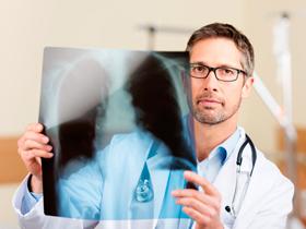 Simpatectomía renal atenúa el remodelado vascular