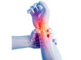 Terapia combinada reduce dolor neuropático relacionado al cáncer