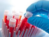 Peptoide ASD1: biomarcador para el autismo