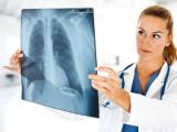 Células alveolares: terapia contra la fibrosis pulmonar idiopática