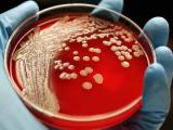 Bacteria comensal produce nuevo antibiótico contra patógenos