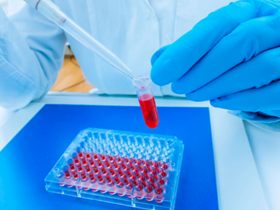 IL-36: potencial blanco contra patologías inflamatorias