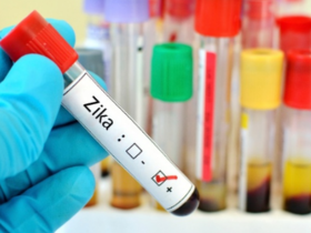 Anticuerpos humanos previenen replicación del virus Zika