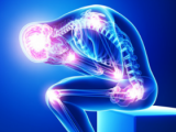 Fibromialgia: patrones anormales de materia gris