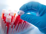 Análisis sanguíneo predice regresión de la leucemia