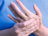 Baricitinib es efectivo contra la artritis reumatoide