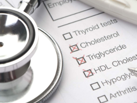 Colesterol HDL no representa un factor de riesgo cardiovascular