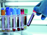 Micro ARN predice cardiomiopatías