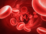 Anemia es prevalente en personas con EII