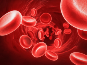 Anemia es prevalente en personas con EII