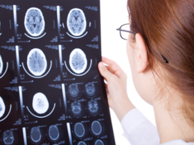 Vuelos espaciales alteran la estructura cerebral