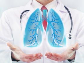 Eosinófilos en esputo pronostican severidad de EPOC