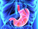 Terapia anti Helicobacter previene cáncer gástrico metacrónico