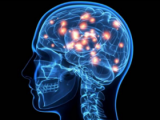 Privación de sueño potencia acumulación β-amiloide