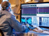Ablación con catéter reduce muertes cardiovasculares