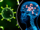 Virus herpes y demencia senil: evidencia de causalidad