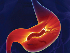 Directrices para el tratamiento de <i>H. pylori </i>