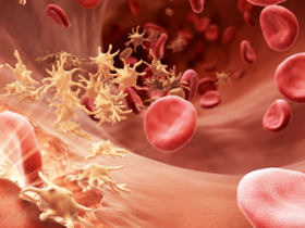 Profilaxis con emicizumab mitiga hemorragias