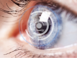 Lentes multifocales son proclives a descentrarse en ojos miopes