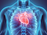 Calcificación aórtica abdominal predice eventos cardiovasculares