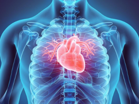 Calcificación aórtica abdominal predice eventos cardiovasculares
