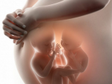 Impacto de la diabetes gestacional en el embarazo múltiple