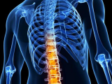 Terapia biológica contra la espondilitis anquilosante