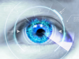 Incisiones pequeñas pueden favorecer el trauma corneal	