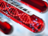 ADN circulante: biomarcador del envejecimiento