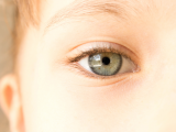 Ciclosporina mejora síntomatología en queratoconjuntivitis vernal