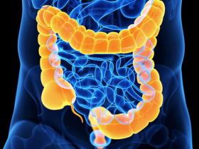 Aganglionosis congénita surge de diversas variantes genéticas