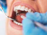 Probióticos previenen candidiasis oral