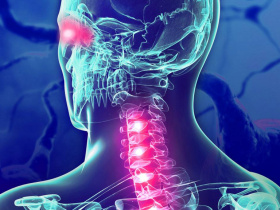 Inebilizumab ayuda al paciente con neuromielitis óptica